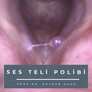 ses-teli-polibi