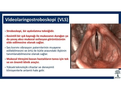 videolaringostroboskopi