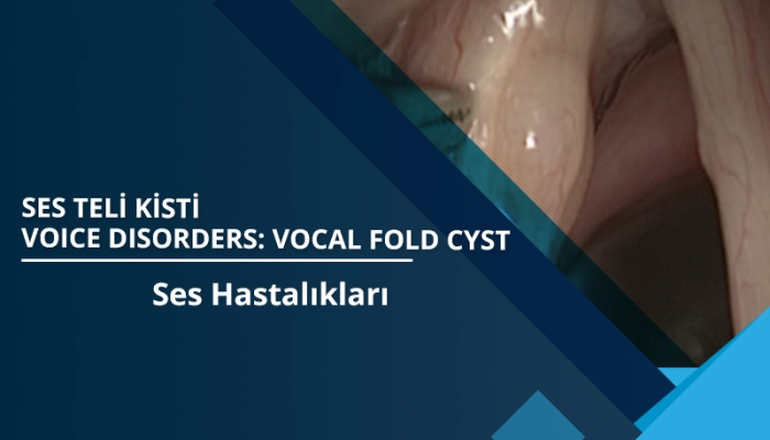 ses-teli-kisti-vocal-fold-cyst