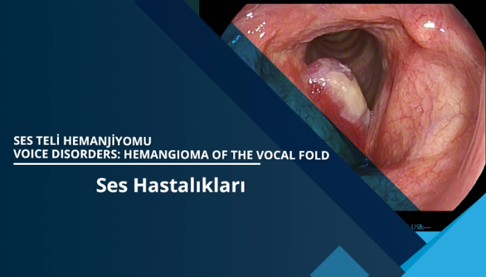 hemangioma-of-the-vocal-fold-laryngeal-hemangioma