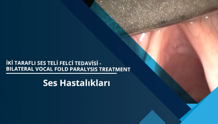 iki-tarafli-ses-teli-felci-tedavisi-bilateral-vocal-fold-paralysis-treatment