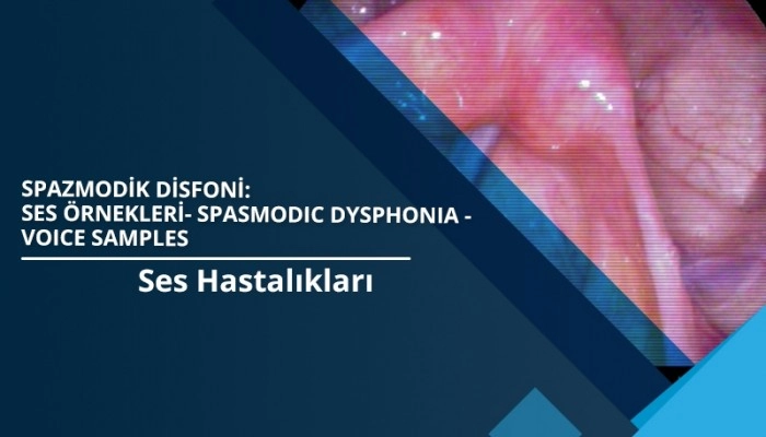 spasmodic-dysphonia-voice-samples