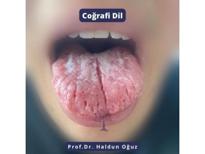 cografi-dil