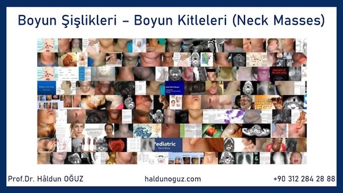 boyun-kitleleri