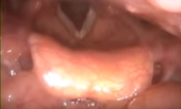 endoskopc4b1k-muayene