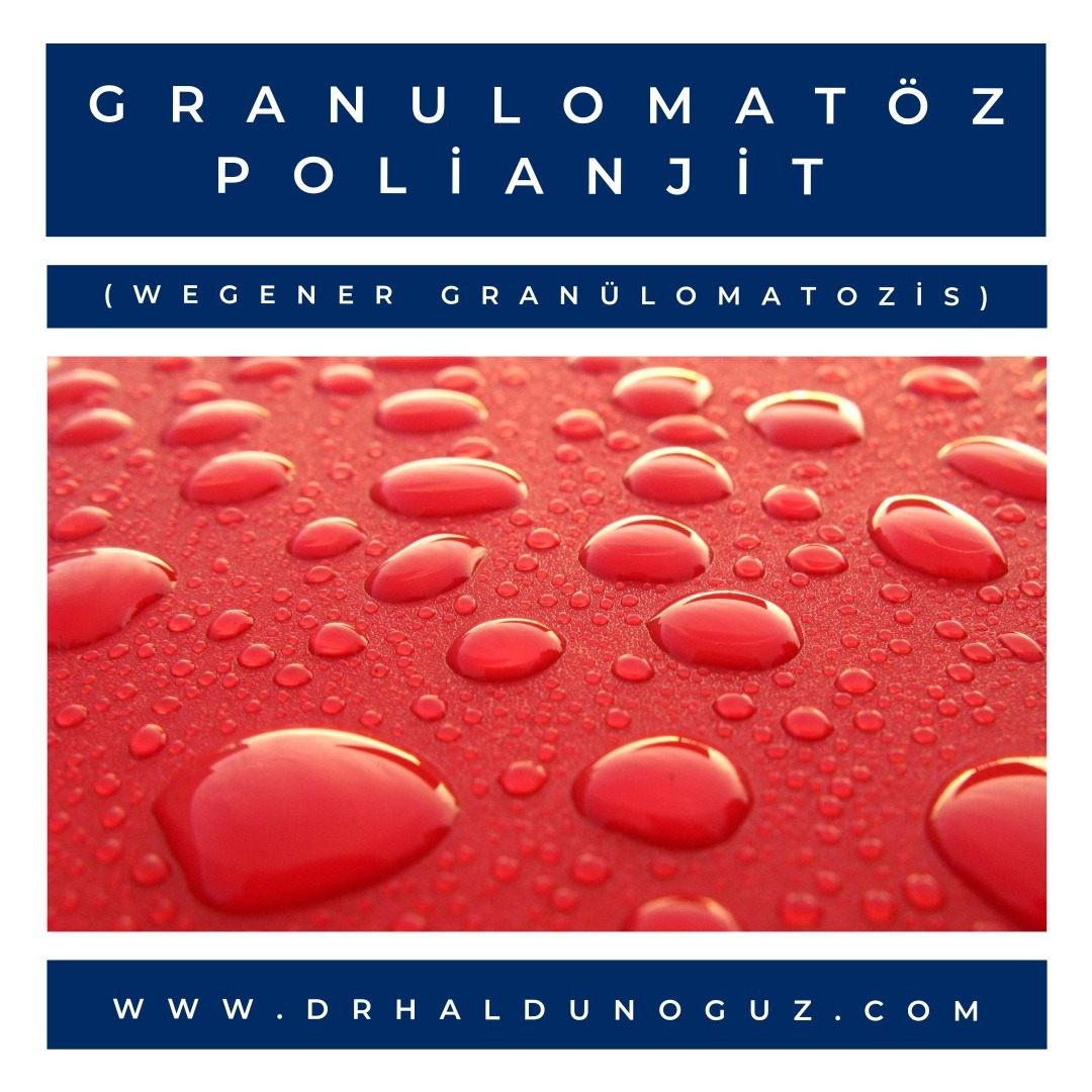granulomatoz-polianjit-wegener-granulomatozis-1