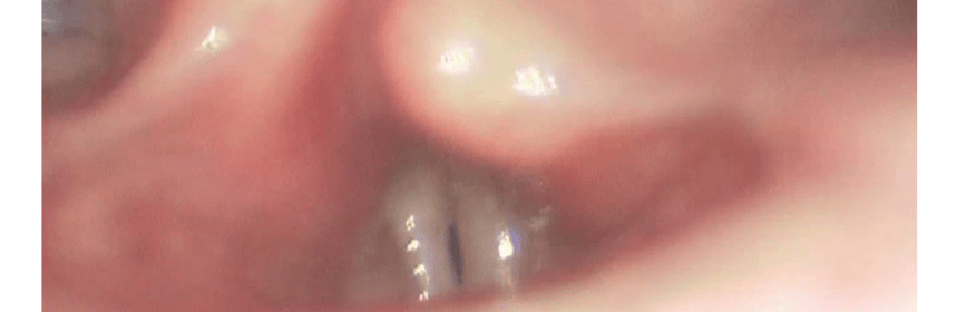 iki-tarafli-ses-teli-felci