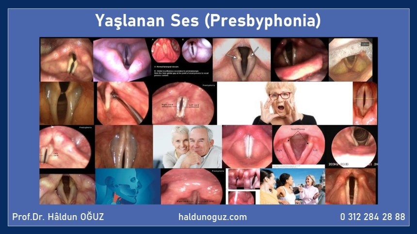 presbifoni