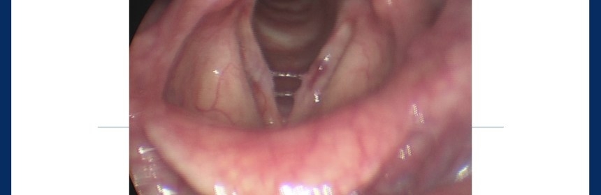 professional-voice-oguz