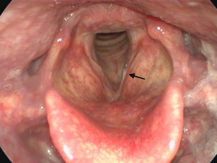 ses-kisikligi-dikkat