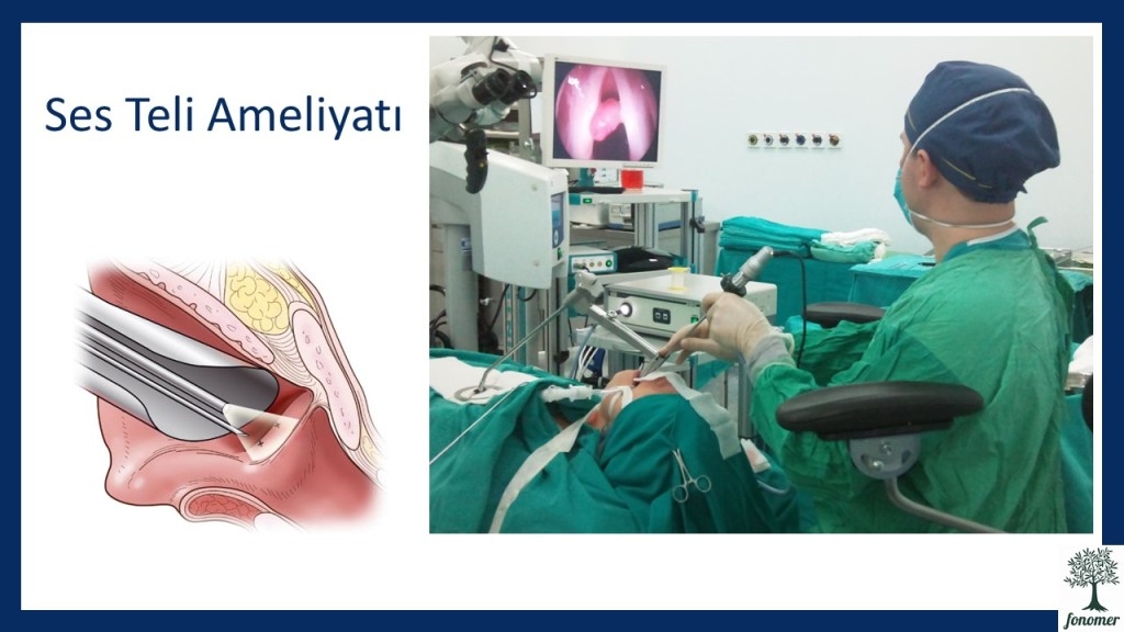 ses-teli-ameliyati-2