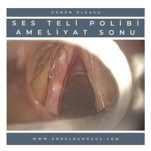 ses-teli-polibi-ameliyat-sonrasi