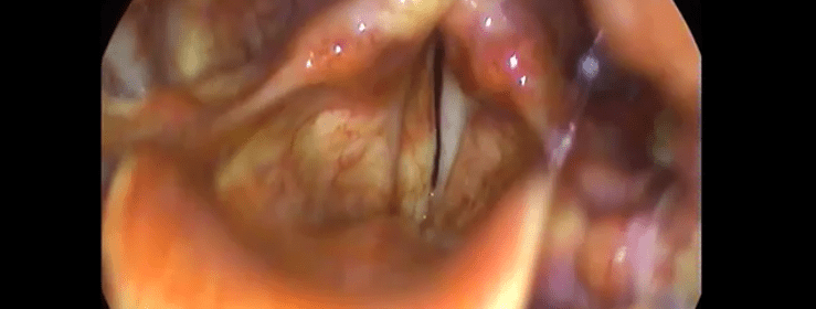 ses-teli-skarc4b1-oguz