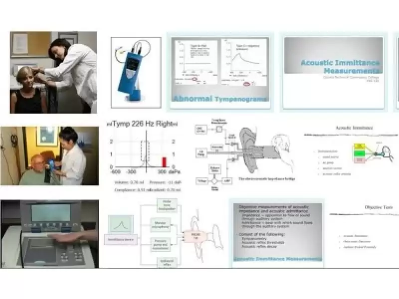 Akustik İmmitansmetri