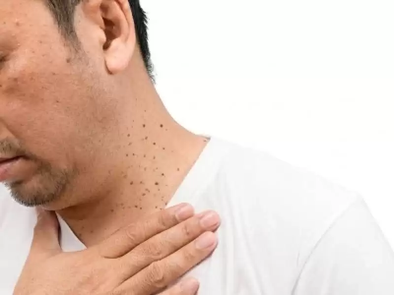 Baş Boyun Kanserlerinde Olası Yayılımın Değerlendirilmesi