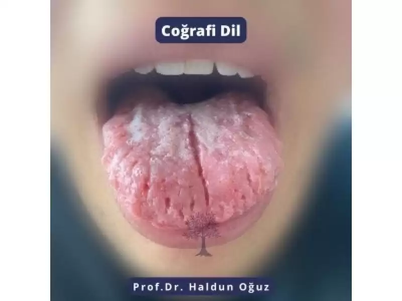 Coğrafi Dil