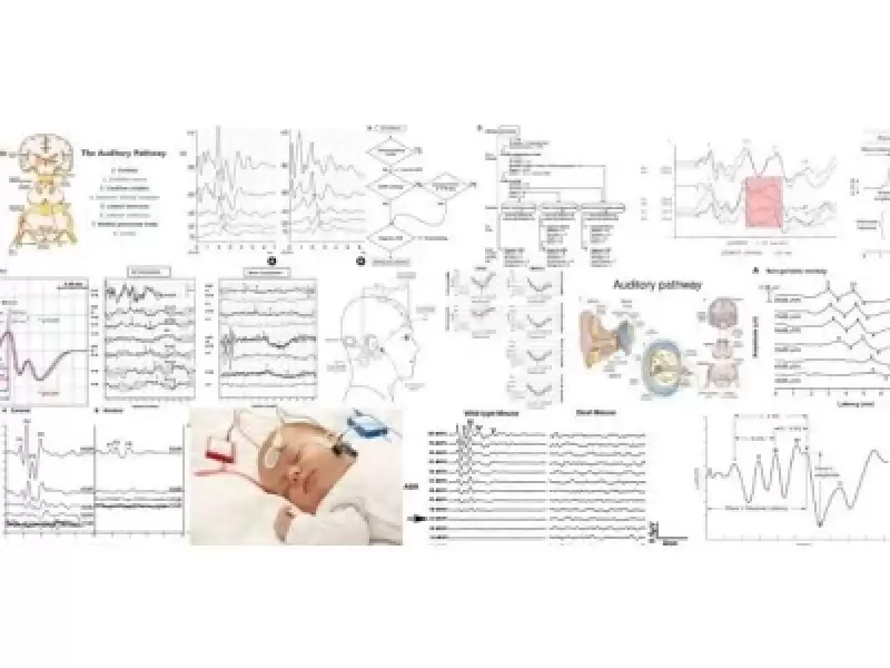 İşitsel Uyarılmış Potansiyeller