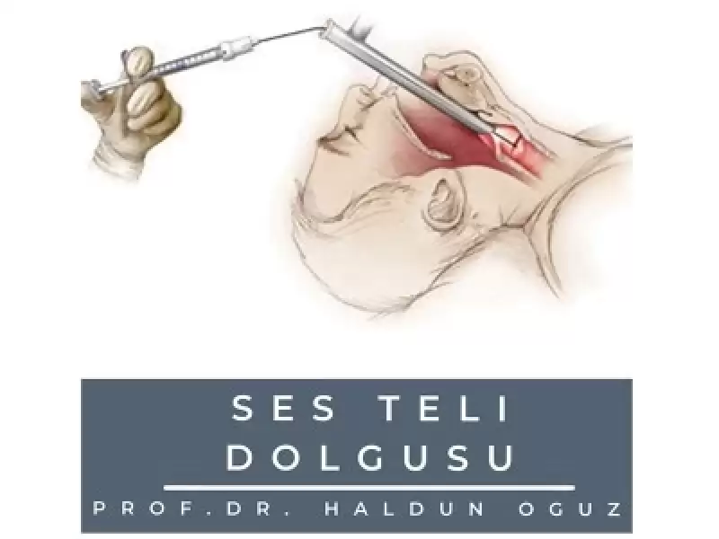 Ses Teli Dolgusu (Enjeksiyon Laringoplasti)