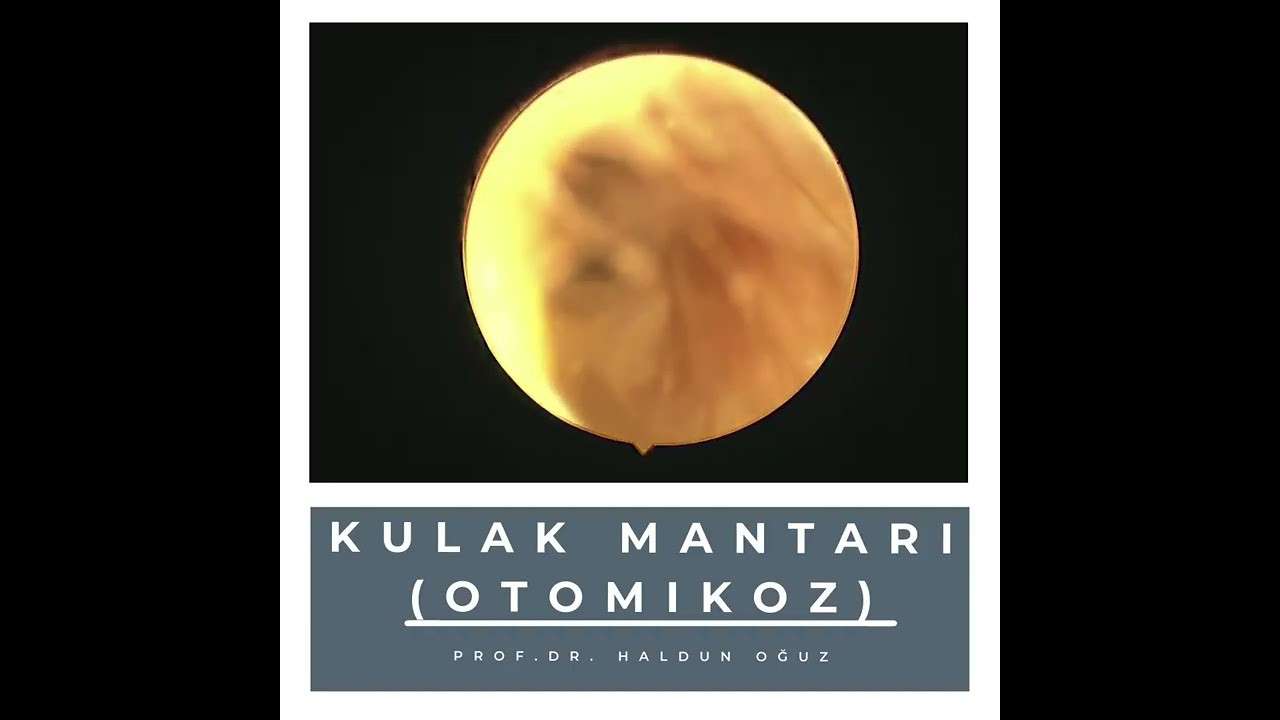 ses ameliyatı,ses cerrahisi,ses teli felci,ses tedavisi,ses terapisi,ses inceltme,ses kalınlaştırma,ses estetiği,ses teli kanseri,gırtlak kanseri,geniz eti,burun ameliyatı,kulak tüpü,çocuk kbb,horlama ameliyatı,kulak burun boğaz profesörü,an