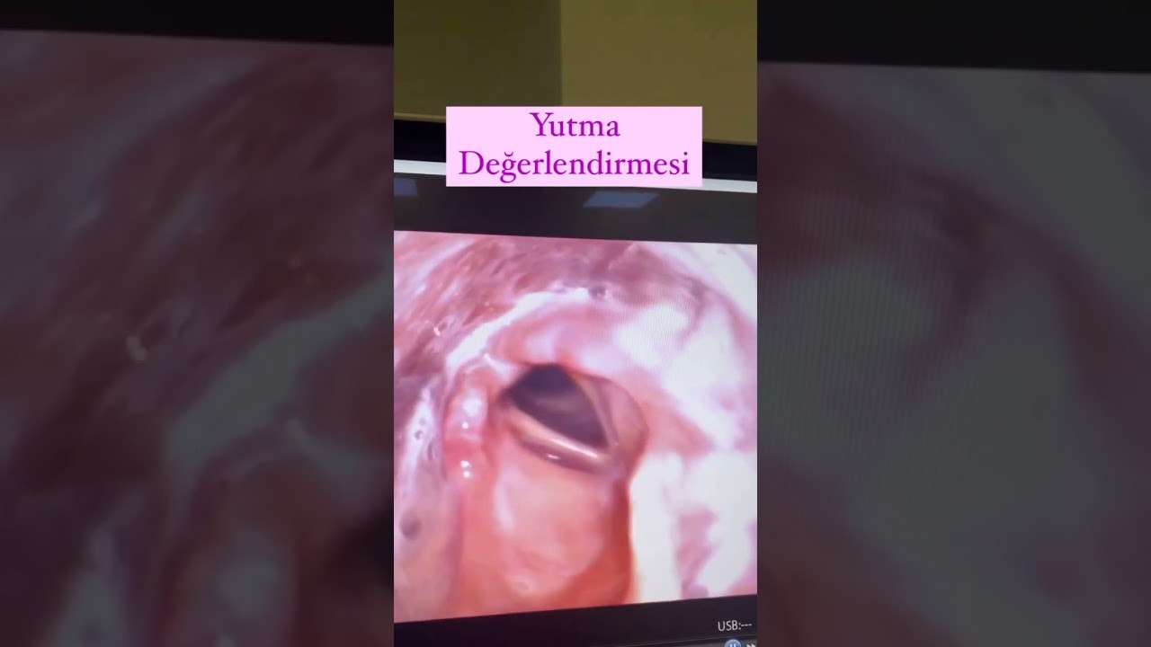 ses ameliyatı,ses cerrahisi,ses teli felci,ses tedavisi,ses terapisi,ses inceltme,ses kalınlaştırma,ses estetiği,ses teli kanseri,gırtlak kanseri,geniz eti,burun ameliyatı,kulak tüpü,çocuk kbb,horlama ameliyatı,kulak burun boğaz profesörü,an