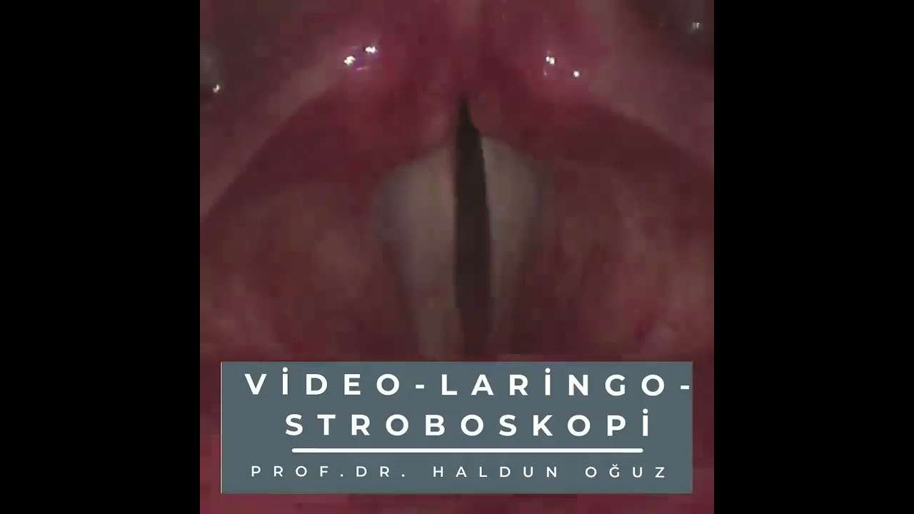 ses ameliyatı,ses cerrahisi,ses teli felci,ses tedavisi,ses terapisi,ses inceltme,ses kalınlaştırma,ses estetiği,ses teli kanseri,gırtlak kanseri,geniz eti,burun ameliyatı,kulak tüpü,çocuk kbb,horlama ameliyatı,kulak burun boğaz profesörü,an