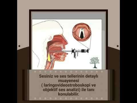 ses ameliyatı,ses cerrahisi,ses teli felci,ses tedavisi,ses terapisi,ses inceltme,ses kalınlaştırma,ses estetiği,ses teli kanseri,gırtlak kanseri,geniz eti,burun ameliyatı,kulak tüpü,çocuk kbb,horlama ameliyatı,kulak burun boğaz profesörü,an