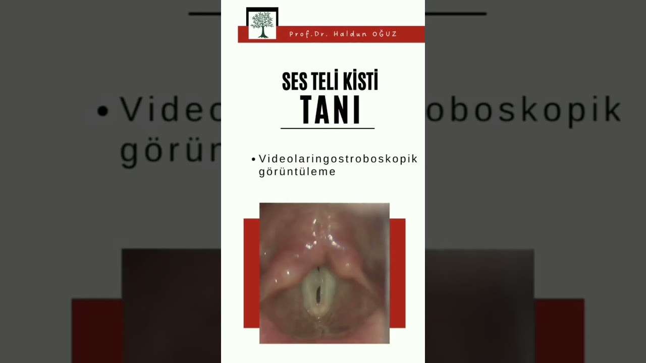 ses ameliyatı,ses cerrahisi,ses teli felci,ses tedavisi,ses terapisi,ses inceltme,ses kalınlaştırma,ses estetiği,ses teli kanseri,gırtlak kanseri,geniz eti,burun ameliyatı,kulak tüpü,çocuk kbb,horlama ameliyatı,kulak burun boğaz profesörü,an