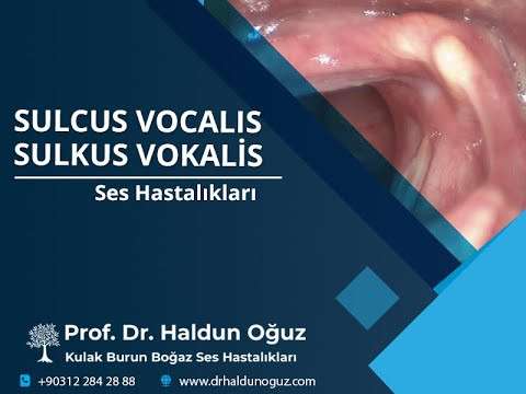 phonosurgery,phonomicrosurgery,ses kisikligi,ses terapisi,ses cerrahisi,ses teli ameliyatı,ses teli cerrahisi,ses teli oluğu,ses telinde oluk,ses telinde sulkus,sulcus vocalis,sulkus vokalis,sulkus vokalis tedavisi,ses estetiği,ses düzeltme,ses tedavi