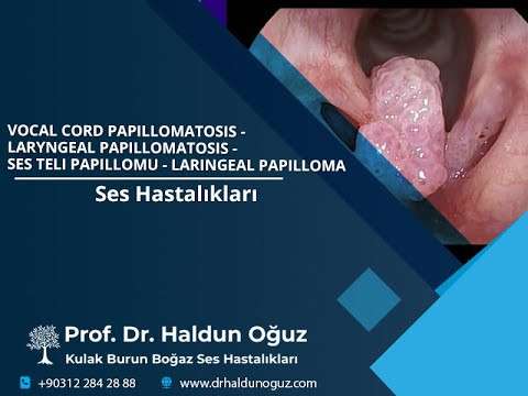 voice surgery,vocal fold,vocal cord,voice,phonosurgery,phonomicrosurgery,throat,larynx,Ankara,voice surgeon,vocal cord papillomatosis