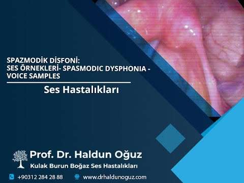 voice surgery,vocal fold,vocal cord,voice,phonosurgery,phonomicrosurgery,therapy,throat,larynx,Ankara,ses kisikligi,seste catallanma,ses terapi,ses terapisi,spazmodik disfoni,spasmodic dysphonia,treatment,ses tedavisi,ses cerrahisi,ses ameliyatı,ses ince