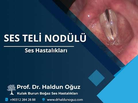 voice surgery,vocal fold,vocal cord,voice,phonosurgery,phonomicrosurgery,polyp,nodule,Reinke,therapy,cancer,throat,larynx,paralysis,paresis,Ankara,ses terapisi,ses tedavisi,ses ameliyatı,ses cerrahisi,ses teli ameliyatı,ses teli cerrahisi,ses doktoru