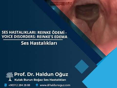 voice surgery,vocal fold,vocal cord,voice,phonosurgery,phonomicrosurgery,Reinke,therapy,Ankara,ses kisikligi,seste catallanma,ses terapi,ses terapisi,ses tedavisi,ses cerrahisi,ses ameliyatı,ses doktoru,Reinke ödemi,Reinke's edema,fonoplasti,phonoplasty