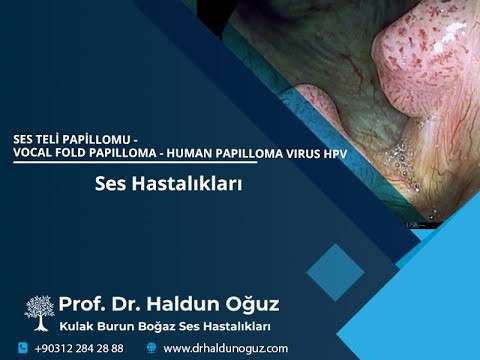 ses cerrahisi,ses tedavisi,ses terapisi,ses inceltme,ses kalınlaştırma,ses estetiği,ses teli kanseri,gırtlak kanseri,ses güzelleştirme,transgender ses,ses ameliyatı,voice surgery,voice esthetics,voice doctor,voice surgeon