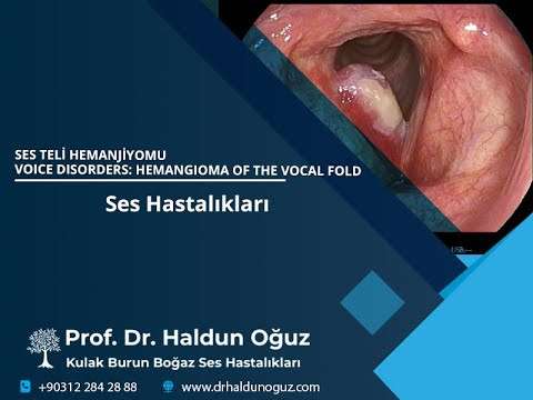 ses ameliyatı,ses cerrahisi,ses tedavisi,ses terapisi,ses inceltme,ses kalınlaştırma,ses estetiği,ses teli kanseri,gırtlak kanseri,kulak burun boğaz profesörü,ankara en iyi kulak burun boğaz,ses güzelleştirme,ses teli tümörü,gırtlak tümö