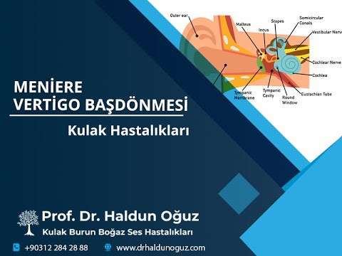 kulak burun boğaz profesörü,kulak ameliyatı,kulak çınlaması,vertigo,baş dönmesi,meniere,kulak burun boğaz