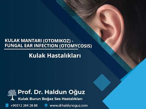 kulak tüpü,çocuk kbb,kulak burun boğaz profesörü,ankara en iyi kulak burun boğaz,kulak ameliyatı,kulak çınlaması,kulak itihabı,kulak akıntısı,kulak cerrahisi,kulak tedavisi,işitme azlığı,kulak damlası