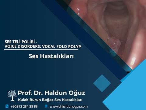 ses ameliyatı,ses cerrahisi,ses tedavisi,ses terapisi,ses estetiği,kulak burun boğaz profesörü,ankara en iyi kulak burun boğaz,ses güzelleştirme,voice surgery,ses muayenesi,ses teli muayenesi