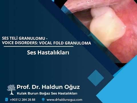 ses ameliyatı,ses cerrahisi,ses teli felci,ses tedavisi,ses terapisi,ses inceltme,ses kalınlaştırma,ses estetiği,ses teli kanseri,gırtlak kanseri,kulak burun boğaz profesörü,ankara en iyi kulak burun boğaz,granulom,ses teli granulomu