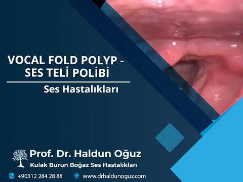 ses ameliyatı,ses cerrahisi,ses tedavisi,ses terapisi,kulak burun boğaz profesörü,ankara en iyi kulak burun boğaz,ses teli polibi,ses telinde polip,ses teli ameliyatı,vocal cord,vocal polyp