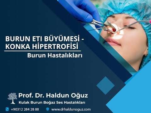 burun ameliyatı,horlama ameliyatı,burun tıkanıklığı ameliyatı,uyku apnesi