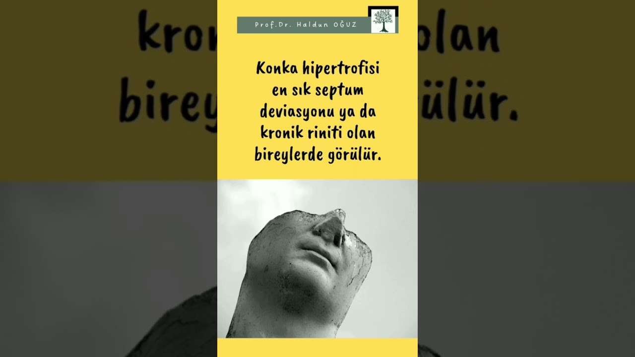 ses ameliyatı,ses cerrahisi,ses teli felci,ses tedavisi,ses terapisi,ses inceltme,ses kalınlaştırma,ses estetiği,ses teli kanseri,gırtlak kanseri,geniz eti,burun ameliyatı,kulak tüpü,çocuk kbb,horlama ameliyatı,kulak burun boğaz profesörü,an