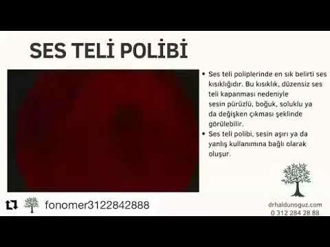 ses ameliyatı,ses cerrahisi,ses teli felci,ses tedavisi,ses terapisi,ses inceltme,ses kalınlaştırma,ses estetiği,ses teli kanseri,gırtlak kanseri,geniz eti,burun ameliyatı,kulak tüpü,çocuk kbb,horlama ameliyatı,kulak burun boğaz profesörü,an