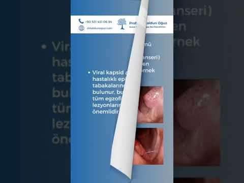 ses ameliyatı,ses cerrahisi,ses teli felci,ses tedavisi,ses terapisi,ses inceltme,ses kalınlaştırma,ses estetiği,ses teli kanseri,gırtlak kanseri,geniz eti,burun ameliyatı,kulak tüpü,çocuk kbb,horlama ameliyatı,kulak burun boğaz profesörü,an