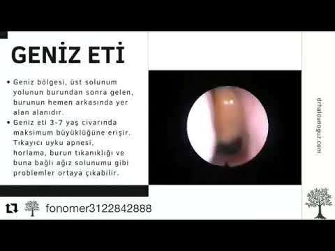 ses ameliyatı,ses cerrahisi,ses teli felci,ses tedavisi,ses terapisi,ses inceltme,ses kalınlaştırma,ses estetiği,ses teli kanseri,gırtlak kanseri,geniz eti,burun ameliyatı,kulak tüpü,çocuk kbb,horlama ameliyatı,kulak burun boğaz profesörü,an