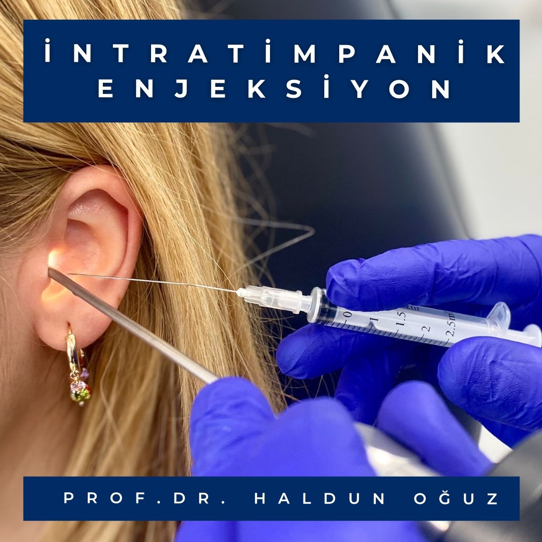 transtimpanik-enjeksiyon