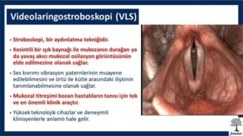 videolaringostroboskopi-nedir