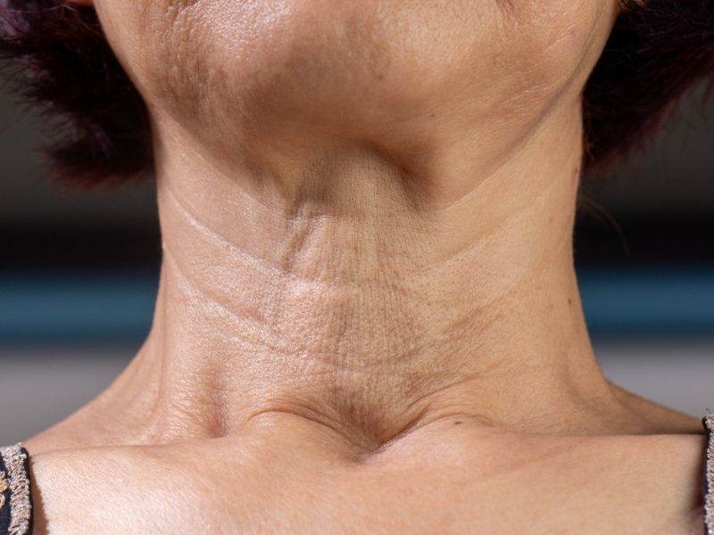 boyunda-sislik-neden-olur